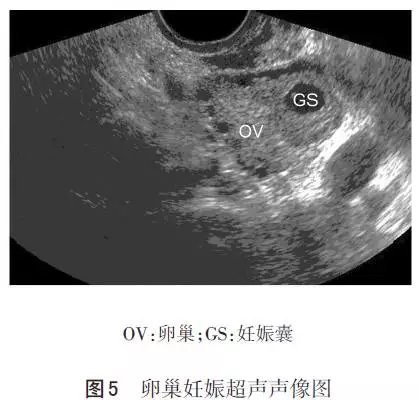 最新型流產(chǎn)技術(shù)，改變未來的希望之光，最新型流產(chǎn)技術(shù)，點(diǎn)亮未來之光