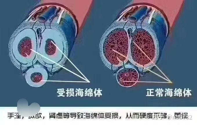 海綿體修復膏的效果與實際應用探討，海綿體修復膏效果及實際應用探討